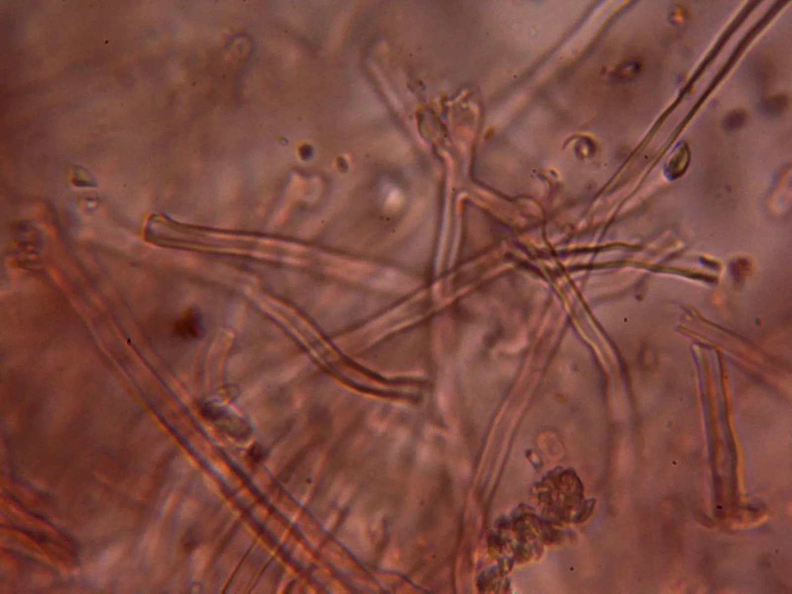 Microscopía de Skeletocutis lilacina - 10 - Hifas subiculares fibuladas